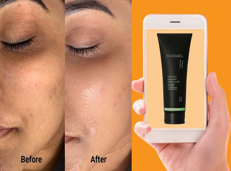 Buttah Skin Before And After Use Results On Your Skin