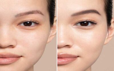 Face Reality Skincare Before And After: Witness A Great Transformation